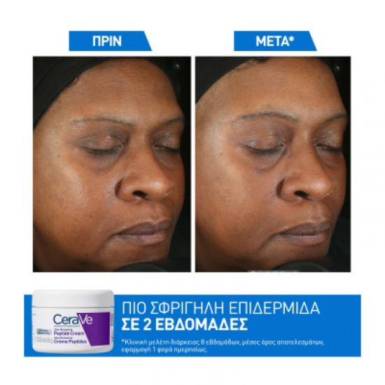 CeraVe Skin Renewing Peptide Cream Κρέμα Προσώπου Νύχτας με Νιασιναμίδη 48g