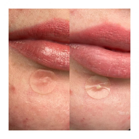 Hero Mighty Patch Invisble+ Επιθέματα για Σπυράκια Αόρατα για Μέρα 24τμχ